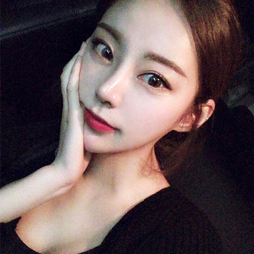 눈매교정수술 혹시 안검하수일까요?마블성형외과의원 관련 이미지 3
