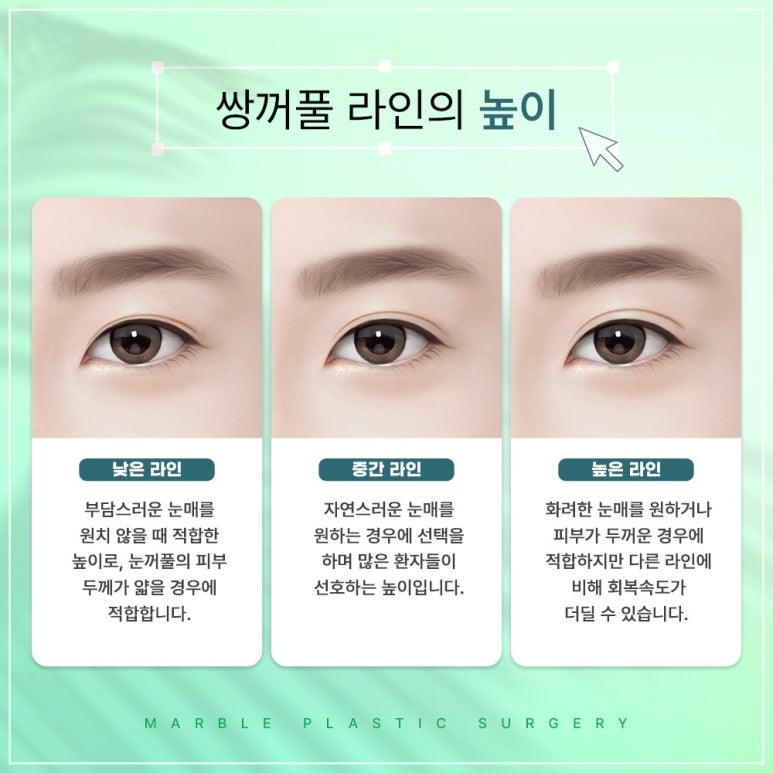 고등학생쌍수 마블이벤트에서 확인, 성형붓기빼는법은 덤으로 관련 이미지 9