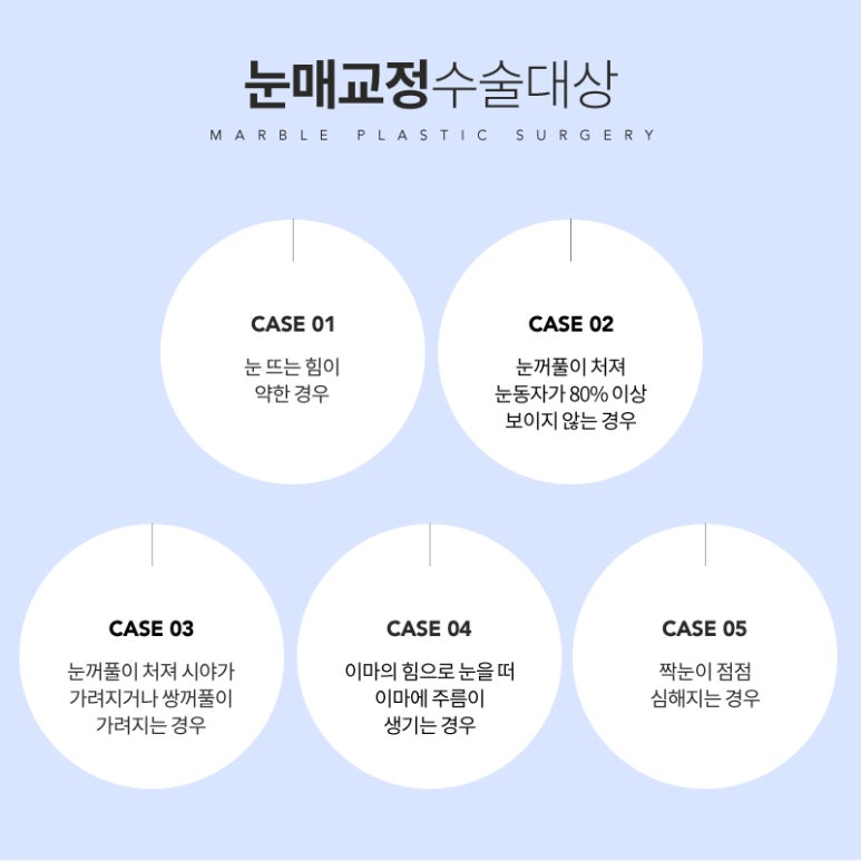 눈매교정 부작용 무엇이 있을까? 관련 이미지 5