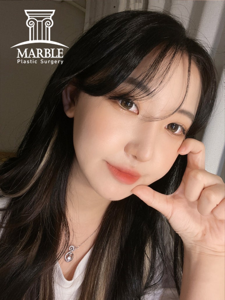 쌍꺼풀수술비용, 합리적인 변화는 마블성형외과의원! 관련 이미지 8
