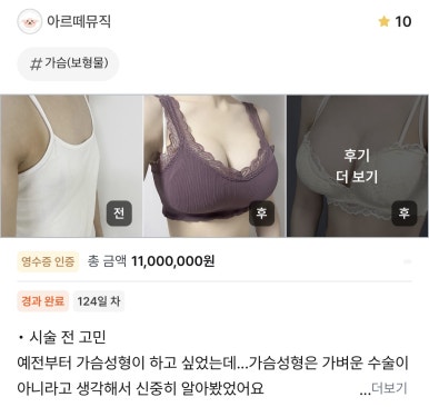 [Gangnam Plastic Surgery Breast Surgery Review] Worried About Asymmetrical Breasts... After Meeting Dr. Seo Il-beom, My Clothes Fit and Look So Much Better! image 1