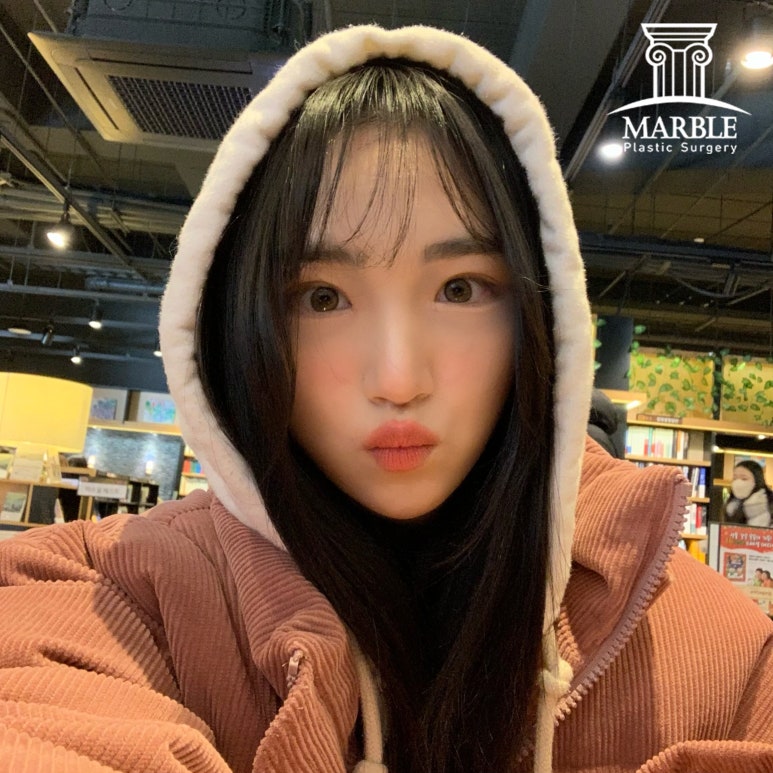 눈매교정 해야 하는 눈일까? 마블성형외과의원에서 알아보자! 관련 이미지 6