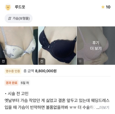 [강남성형외과 가슴수술 리얼후기] 드레스 투어 전 짝가슴 고민 해결! 본식 피팅 완벽 성공이에요ㅎ 관련 이미지 1
