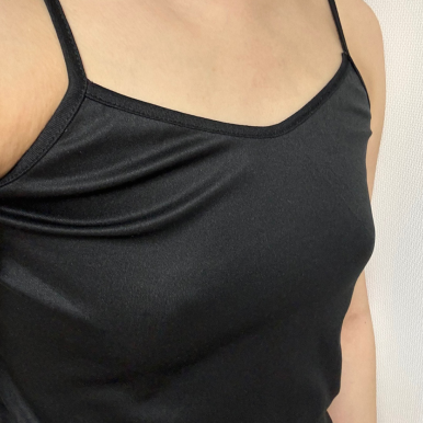 [Gangnam Plastic Surgery Breast Augmentation Real Review] My asymmetry was so severe that my underwear gapedㅠㅠ Customized volumes for each side solved my concern! image 3