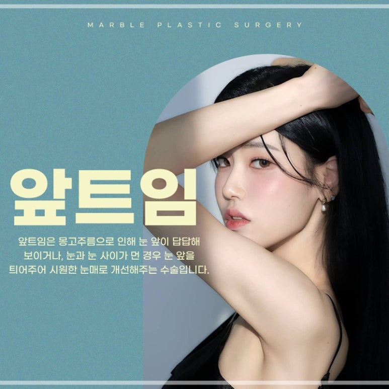앞트임복원, 흉터걱정없이 깔끔하게 관련 이미지 1