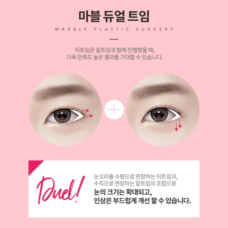 듀얼트임 뒷트임밑트임 동시에! 관련 이미지 6