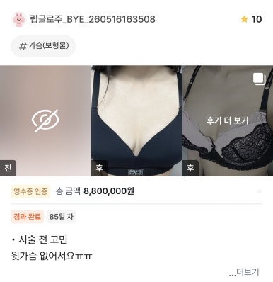 [Gangnam Plastic Surgery Breast Augmentation Review] I Used to Feel Self-Conscious About My Slim Figure Without Any Volume… Now I Have Beautiful Volume That Suits Me Perfectly! image 1