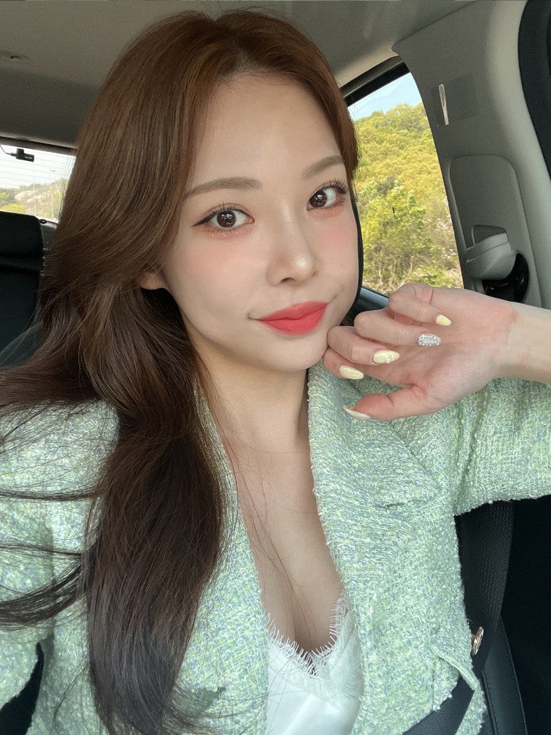 첫 쌍꺼풀수술, 재수술이 하고 싶지 않다면? 관련 이미지 5