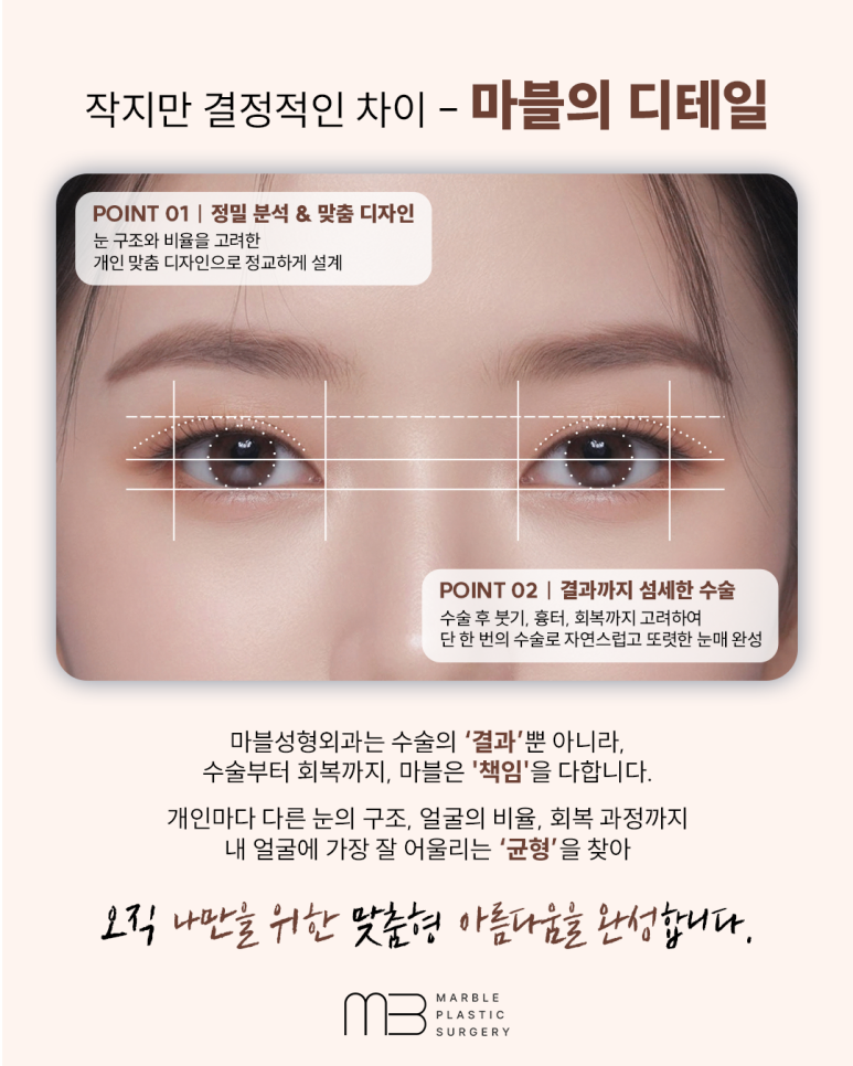 강남역 쌍수 잘하는 병원 잘 찾아보는 방법 관련 이미지 2