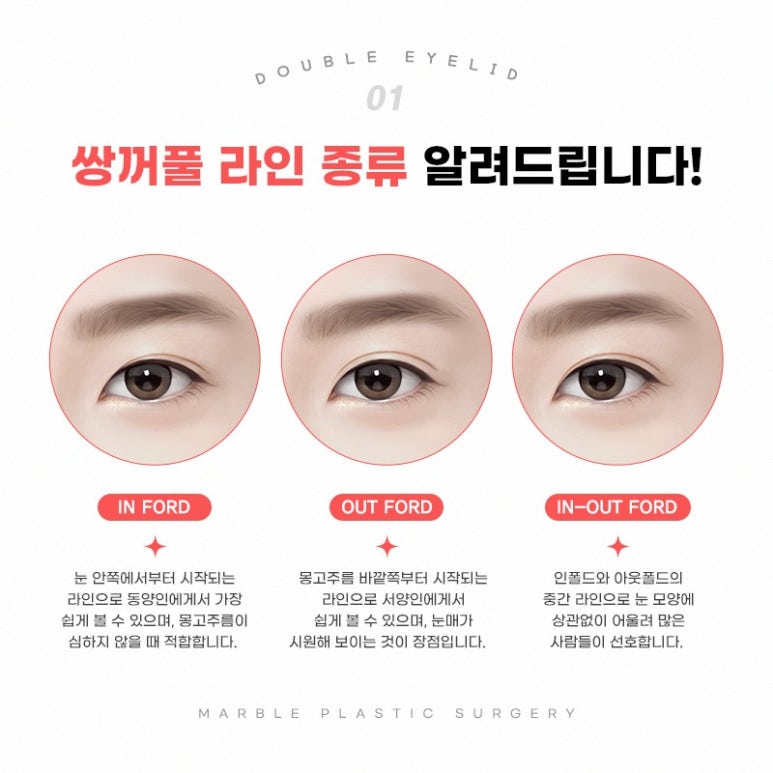 눈성형으로 얼굴비율 맞추기! 디자인의 중요성 관련 이미지 5