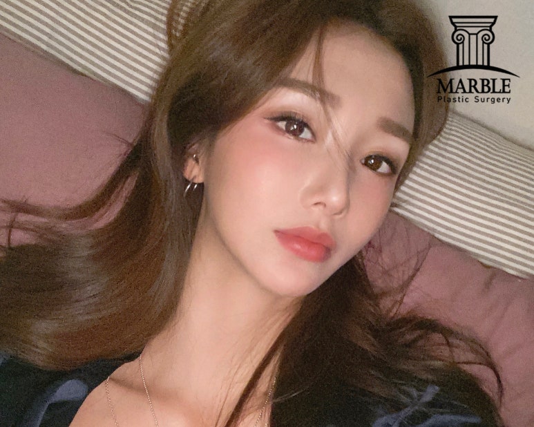 쌍꺼풀수술 후 관리 마블성형외과의원에서 정보 얻기! 관련 이미지 4