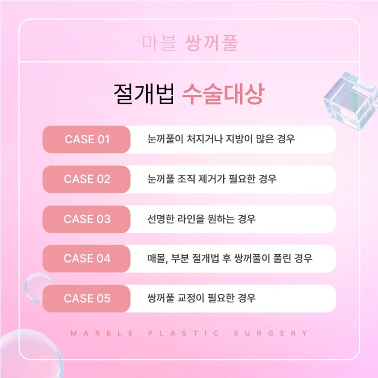 쌍수절개 좋은 선택을 하는 방법 관련 이미지 4