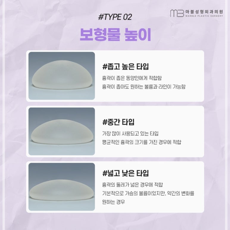 Motiva Breast Revision Surgery Timing and Implant Shape & Height Selection Guide | Marble Plastic Surgery Clinic image 12