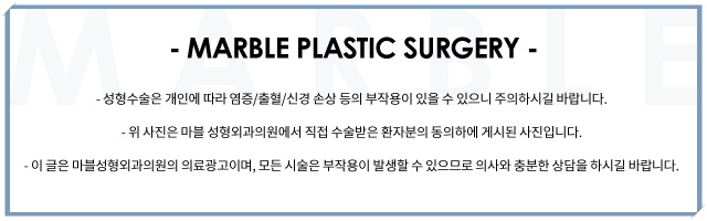 트임수술은 마블성형외과의원 관련 이미지 13
