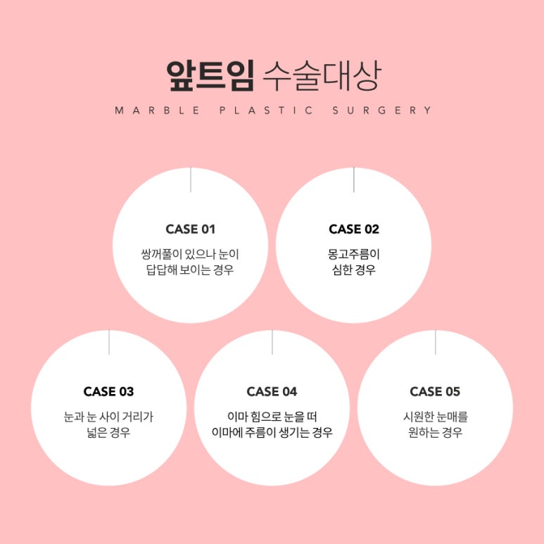 앞트임흉살 걱정되시나요? 마블성형외과의원 관련 이미지 3