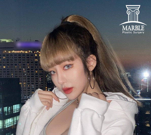 듀얼트임, 자연스럽게 예뻐지는 방법! 마블성형외과의원 관련 이미지 4