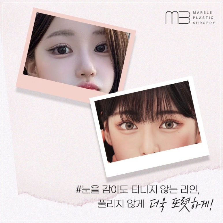 고등학생성형이벤트, 안전하고 현명하게 선택하는 법 관련 이미지 7