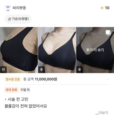 [강남역성형외과 가슴수술 후기] 빈약했던 가슴이 고민이었는데 서일범 원장님 만나고 인생 볼륨 찾았어요! 관련 이미지 1