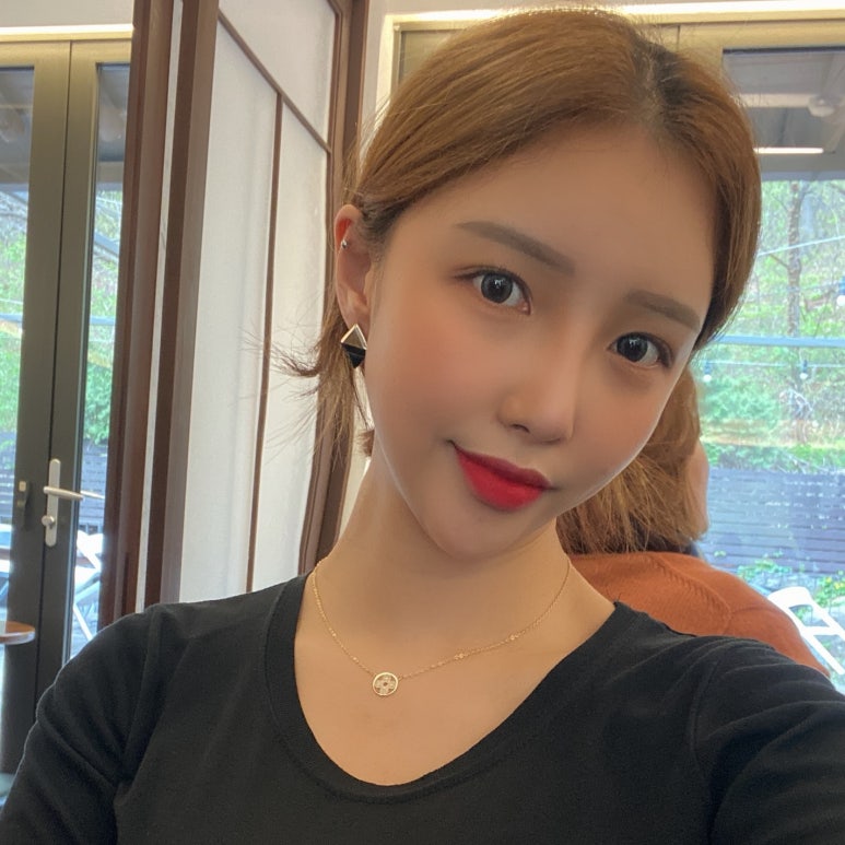 뒤트임가격 원하던 눈매로 변화 관련 이미지 6