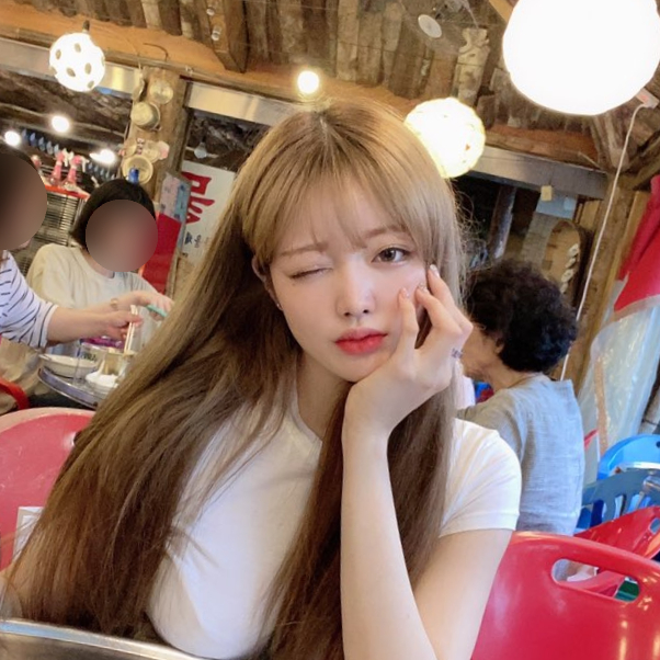 쌍수붓기기간 수술법에 따라 달라져 관련 이미지 5