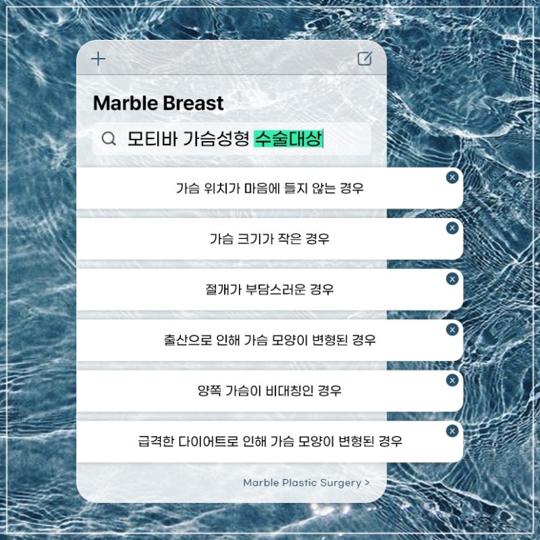 Key Points You Should Know Before Choosing the Motiva Breast Surgery Price | Marble Plastic Surgery image 9