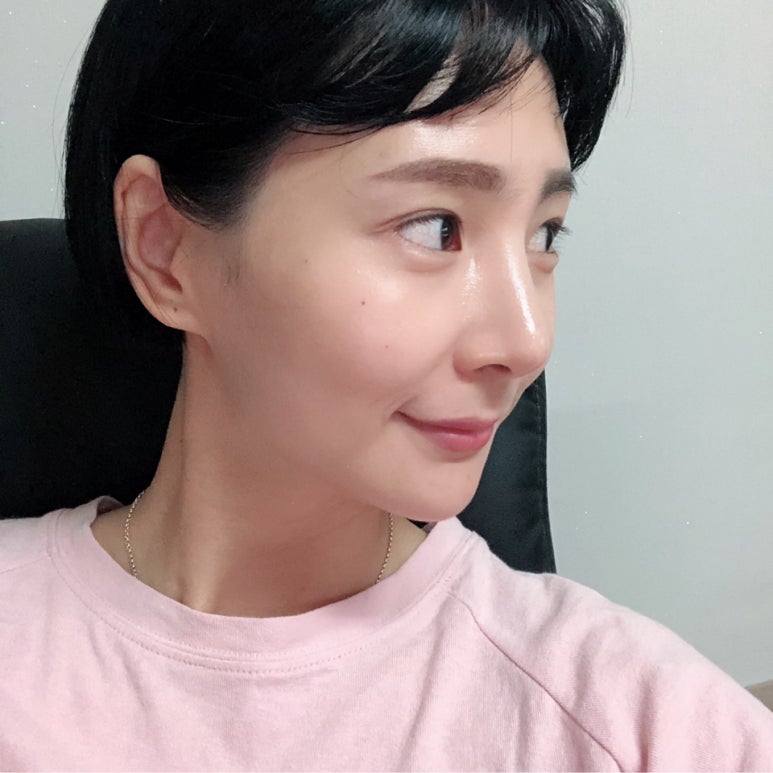눈매교정수술 혹시 안검하수일까요?마블성형외과의원 관련 이미지 6