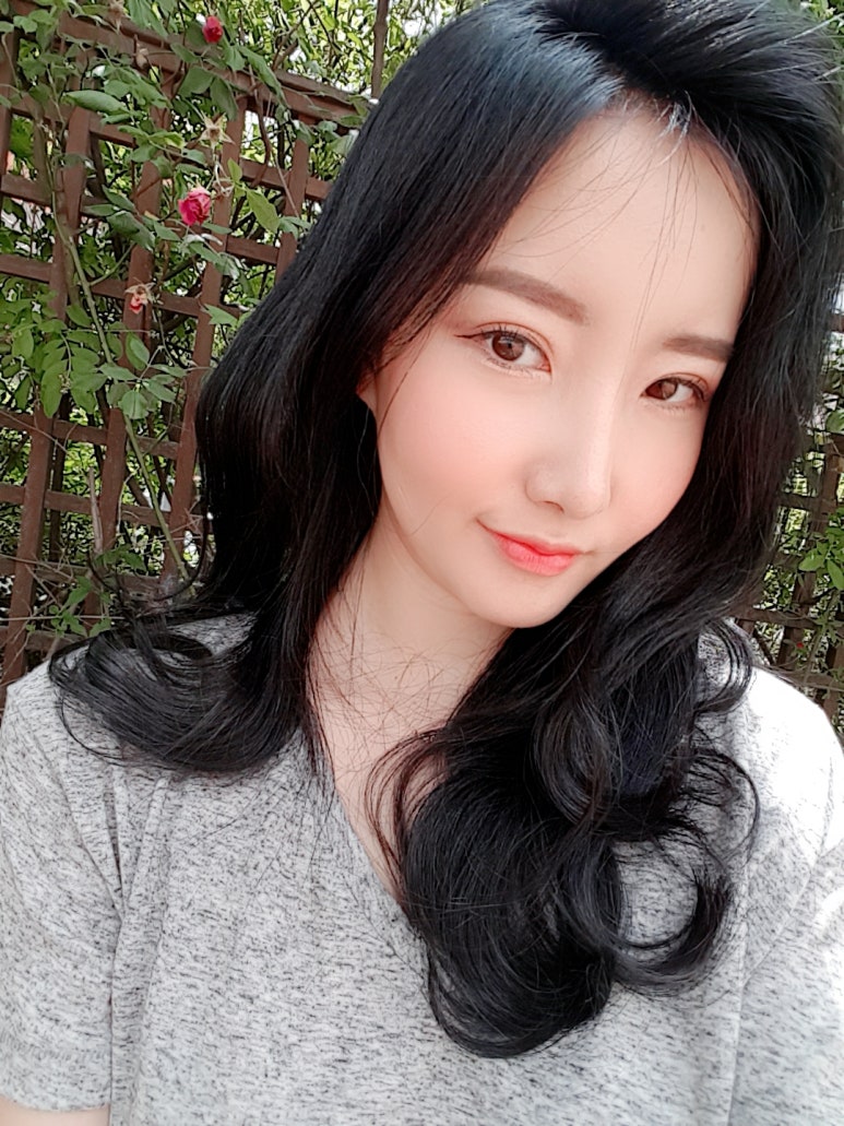 눈밑지방재배치잘하는곳 칙칙한 인상에서 벗어나 관련 이미지 6