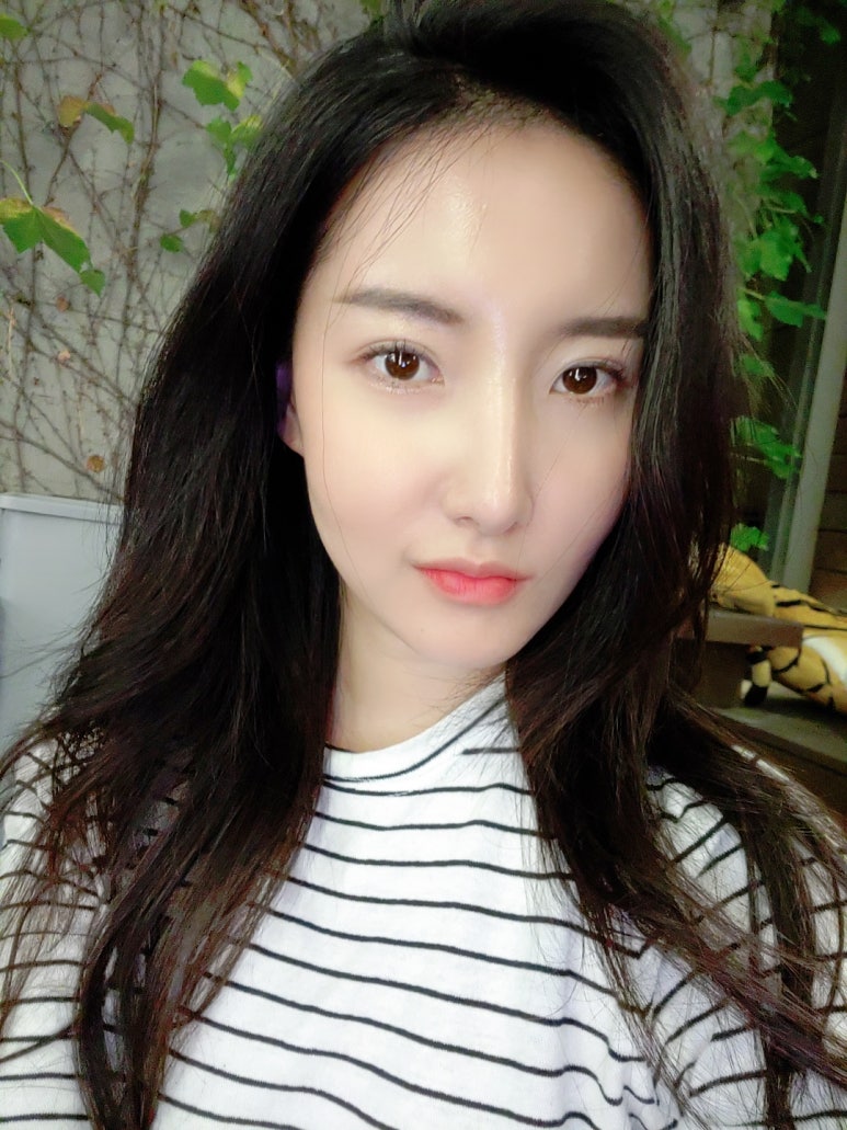 쌍꺼풀재수술잘하는곳 만족도를 위해 관련 이미지 8