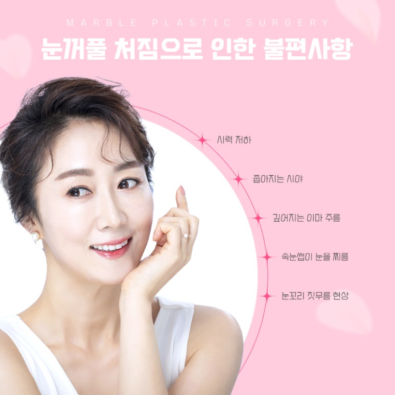 상안검수술비용 따지기 전에 확인하자 관련 이미지 3