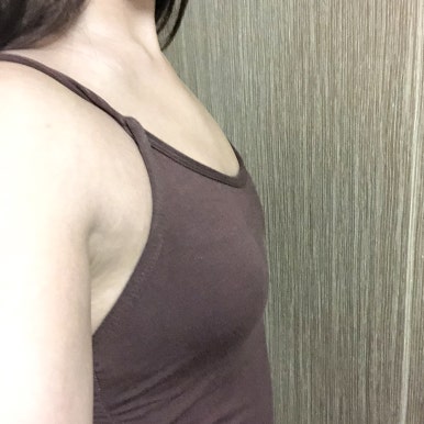 [강남성형외과 가슴성형 후기] 수영복 입을 때 속상했었는데.. 이젠 얇은 티셔츠만 입어도 행복해지네요ㅎㅎ 관련 이미지 4