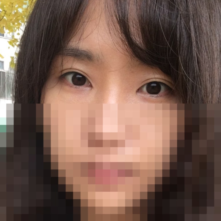 자연유착후기 자연스러워서 맘에 들어요! 관련 이미지 8