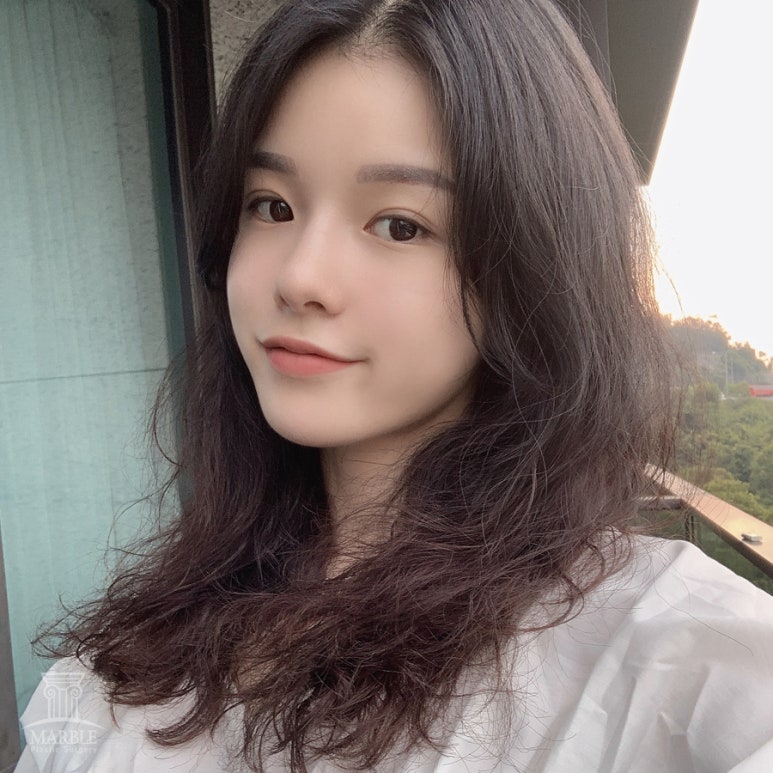 눈재수술비용 알아보고 있다면 관련 이미지 8