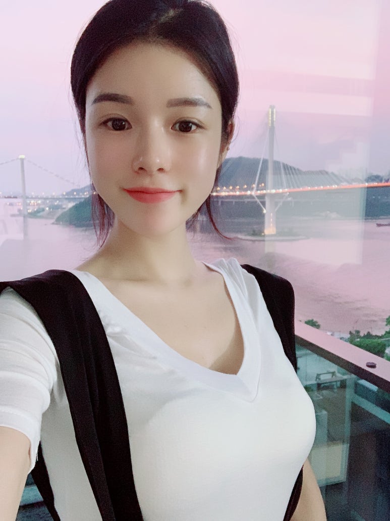 자연유착쌍꺼풀 자연스럽고 섬세하게 마블성형외과의원 관련 이미지 3