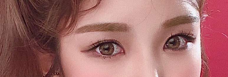 자연유착쌍꺼풀 흉터 풀림 고민 말고 내추럴함!마블성형외과의원 관련 이미지 5