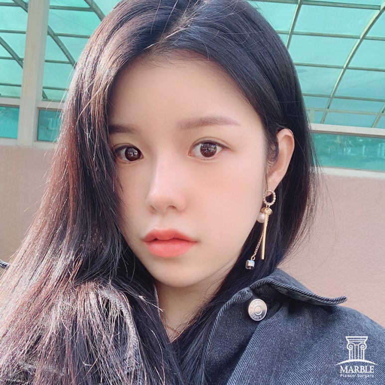 눈재수술비용 알아보고 있다면 관련 이미지 2