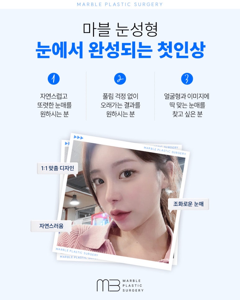수험생눈성형 알아 볼 때 고려해야 할 것은? 관련 이미지 4