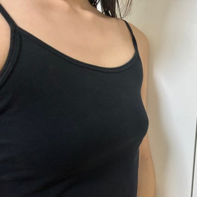 [마블성형외과 가슴성형 후기] 재수술이라 정말 무서웠는데, 원장님 확신 한마디에 믿고 맡기길 정말 잘했어요! 관련 이미지 4