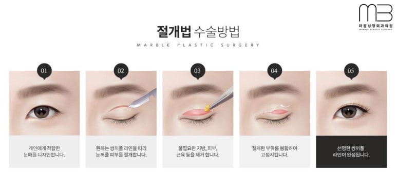 첫쌍수 리얼상세후기 마블 관련 이미지 14