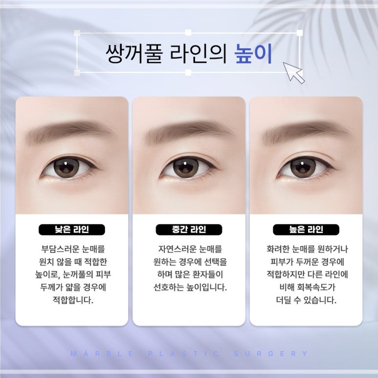 자연유착쌍꺼풀후기 눈매를 더욱 또렷하게 관련 이미지 11