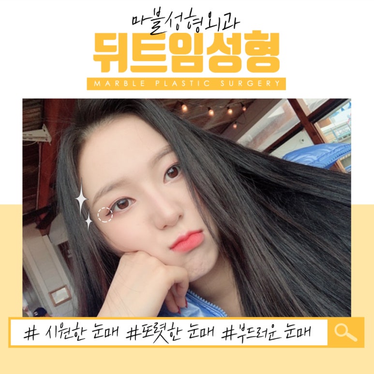 눈뒤트임이 고민이라면? 마블성형외과의원 관련 이미지 2