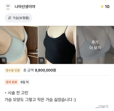 [강남역 성형외과 가슴수술 후기] 묘하게 아쉬웠던 옷 핏.. 자연스러운 볼륨으로 자신감이 생겼어요! 관련 이미지 1