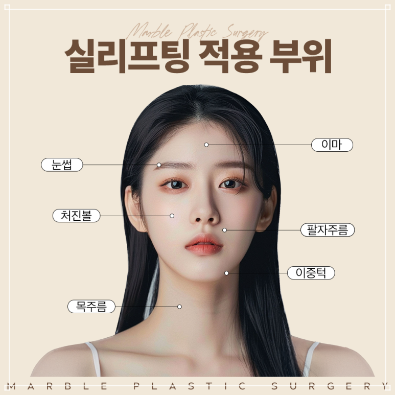 강남실리프팅 추천 대상&middot;부위&middot;효과는? 마블성형외과의원 총정리 관련 이미지 4
