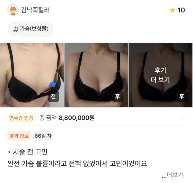 [Gangnam Plastic Surgery Breast Augmentation Review] I Had No Volume at All in the Past... I Was Reborn with Mentor Implants, Haha image 1