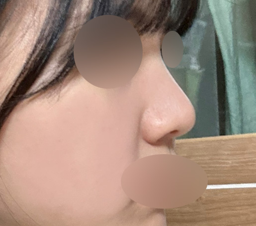 복코수술비용, 정확하게 찾아봐야 하는 이유 관련 이미지 3