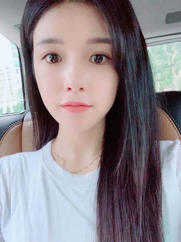 뒷트임후기는 물론 수술방법까지 달리하여 마블성형외과의원 관련 이미지 4