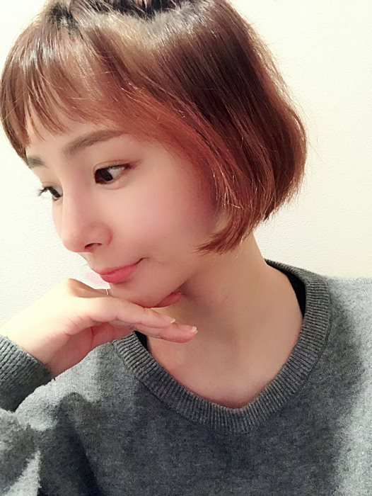 내시경이마거상술 확실한 이마주름제거 가능할까? 마블성형외과의원 관련 이미지 3