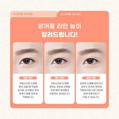 쌍수매몰 알아야 할 사실들 마블성형외과의원 관련 이미지 8