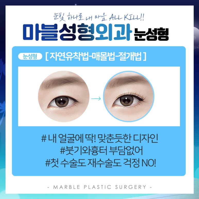 자연유착쌍꺼풀 흉터 풀림 고민 말고 내추럴함!마블성형외과의원 관련 이미지 7