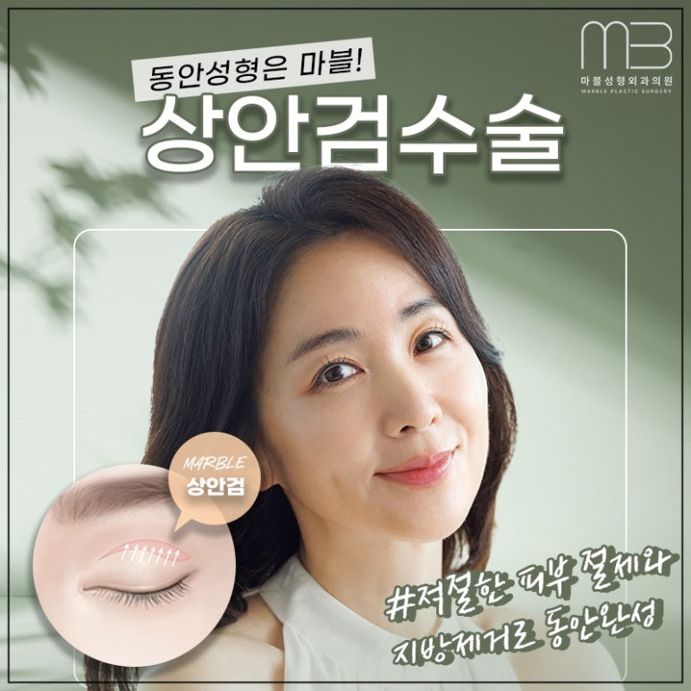 What Is the Difference Between Midlife Upper Eyelid Surgery and Double Eyelid Surgery? image 1