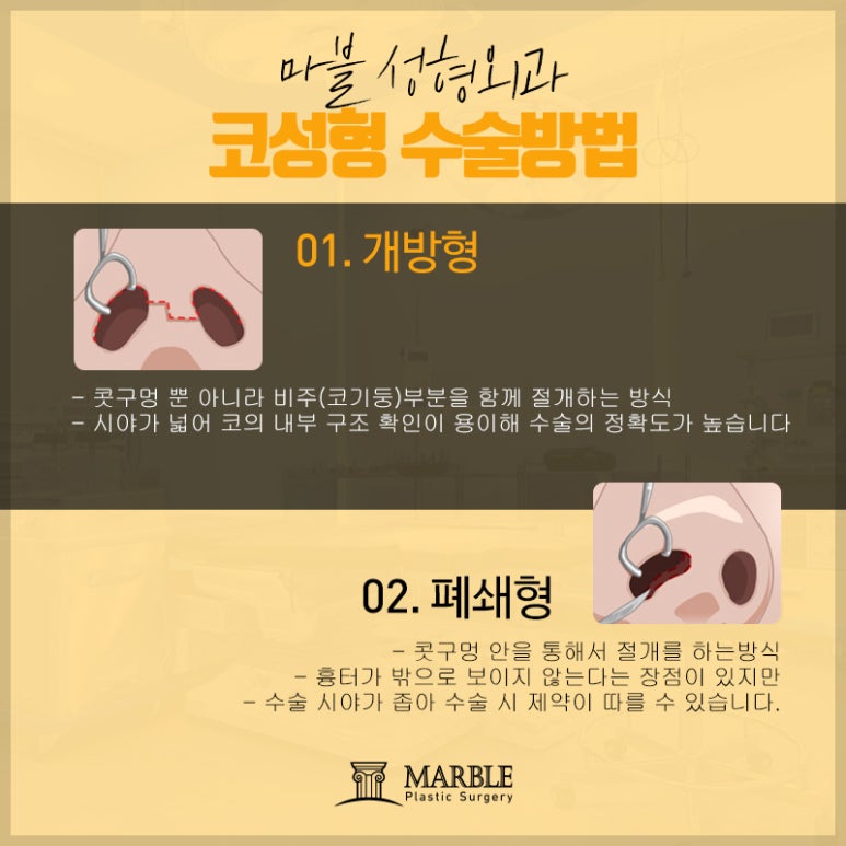 코성형비용과 낮은코성형후기 자세히!마블성형외과의원 관련 이미지 11